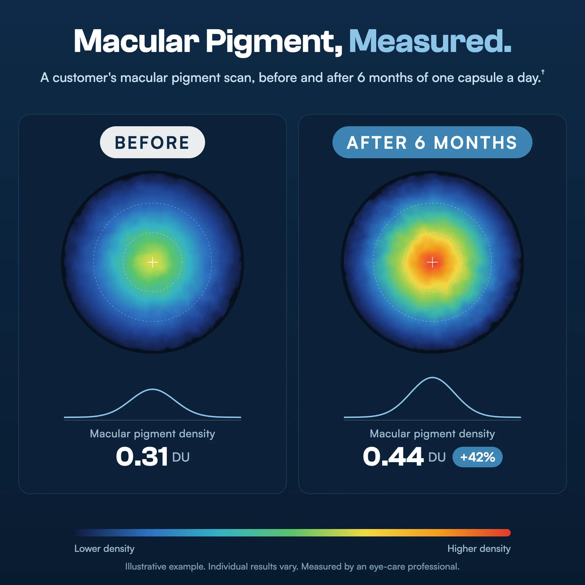 Macular pigment density scan before and after 6 months of Novelys (illustrative example)